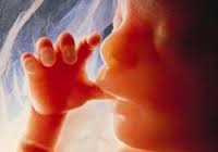 زعفران برای سقط جنین